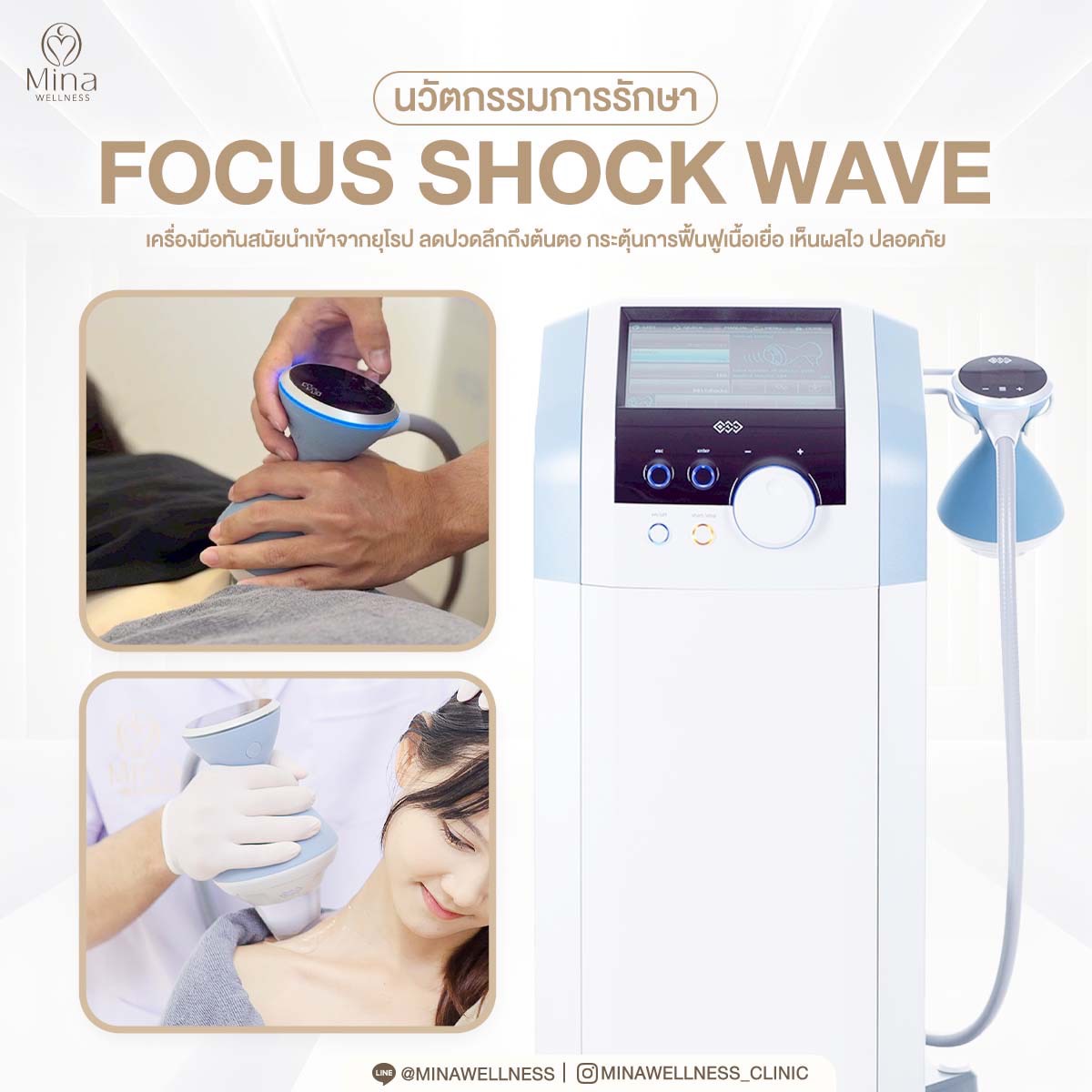 Focus Shock Wave เครื่องมือกายภาพบำบัดนำเข้าจากยุโรป ที่ Mina Wellness ใช้รักษาอาการปวดกล้ามเนื้อและกระตุ้นการฟื้นฟูเนื้อเยื่อ