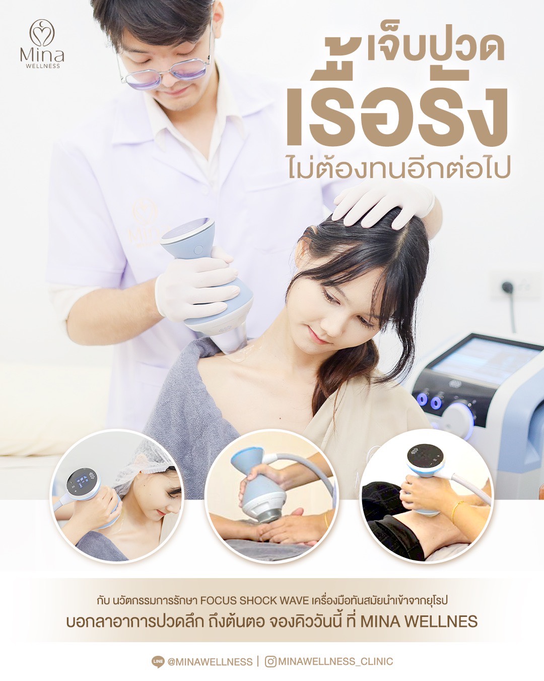 Focus Shock Wave ที่ Mina Wellness เครื่องกายภาพบำบัดนำเข้าจากยุโรป ใช้รักษาอาการปวดเรื้อรัง ปวดหลัง ปวดไหล่ และ Office Syndrome อย่างมีประสิทธิภาพ
