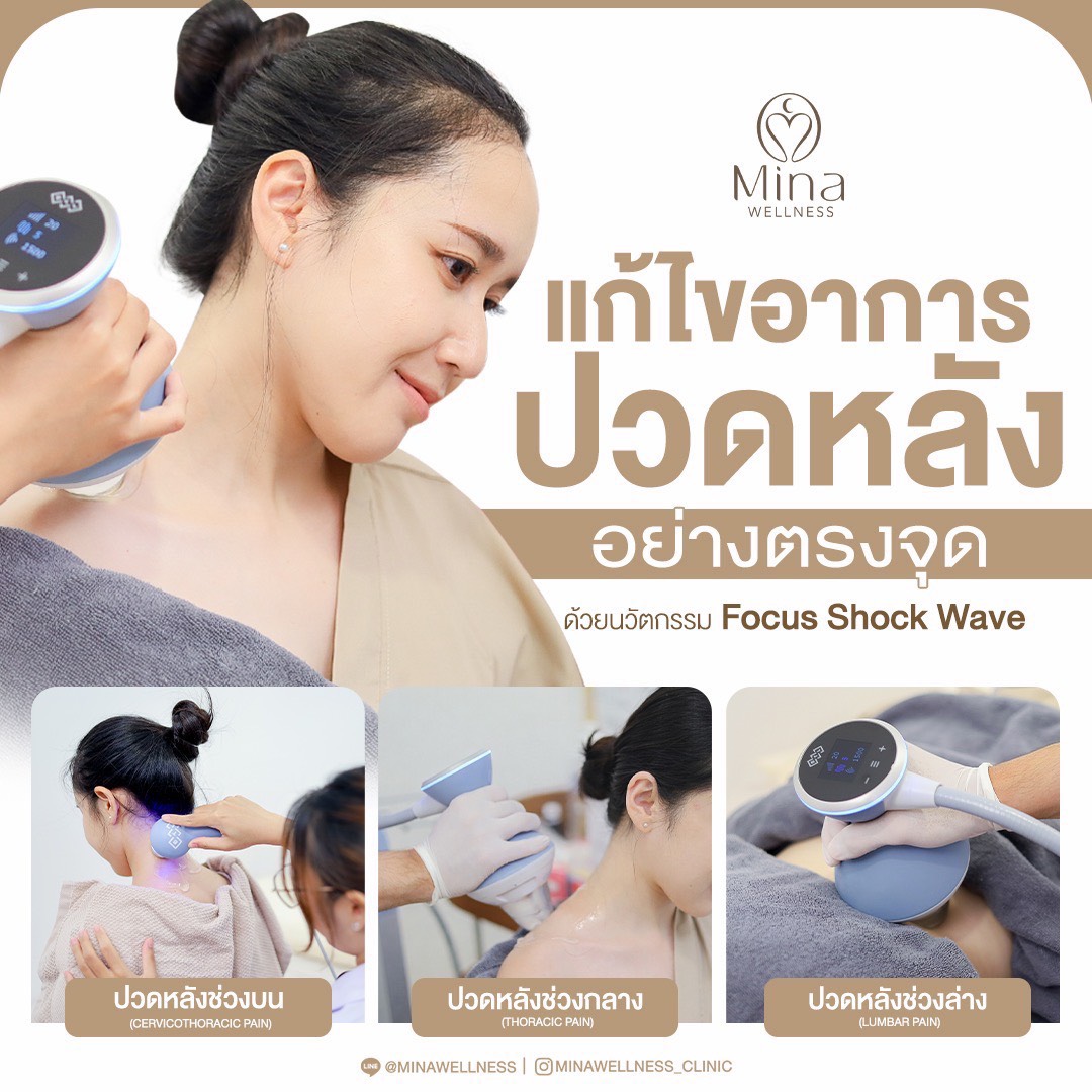การรักษาอาการปวดหลังด้วยเครื่อง Focus Shock Wave โดยนักกายภาพบำบัดที่ Mina Wellness Physical Therapy Clinic ช่วยลดอาการปวดคอ บ่า ไหล่ และปวดหลังอย่างตรงจุด
