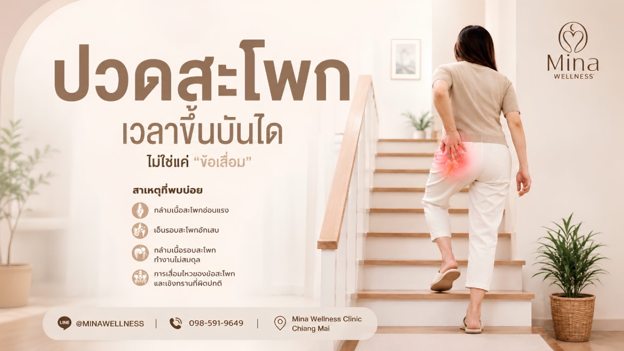 ผู้หญิงกำลังเดินขึ้นบันไดและมีอาการปวดบริเวณสะโพก สื่อถึงอาการปวดสะโพกเวลาขึ้นบันได พร้อมข้อมูลเกี่ยวกับสาเหตุและการดูแลด้วยกายภาพบำบัด